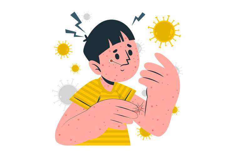 Visuel illustrant la rougeole